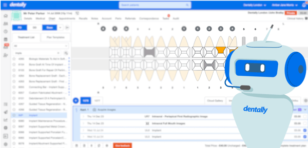 Sneak Peek of the upcoming chart screen changes! 