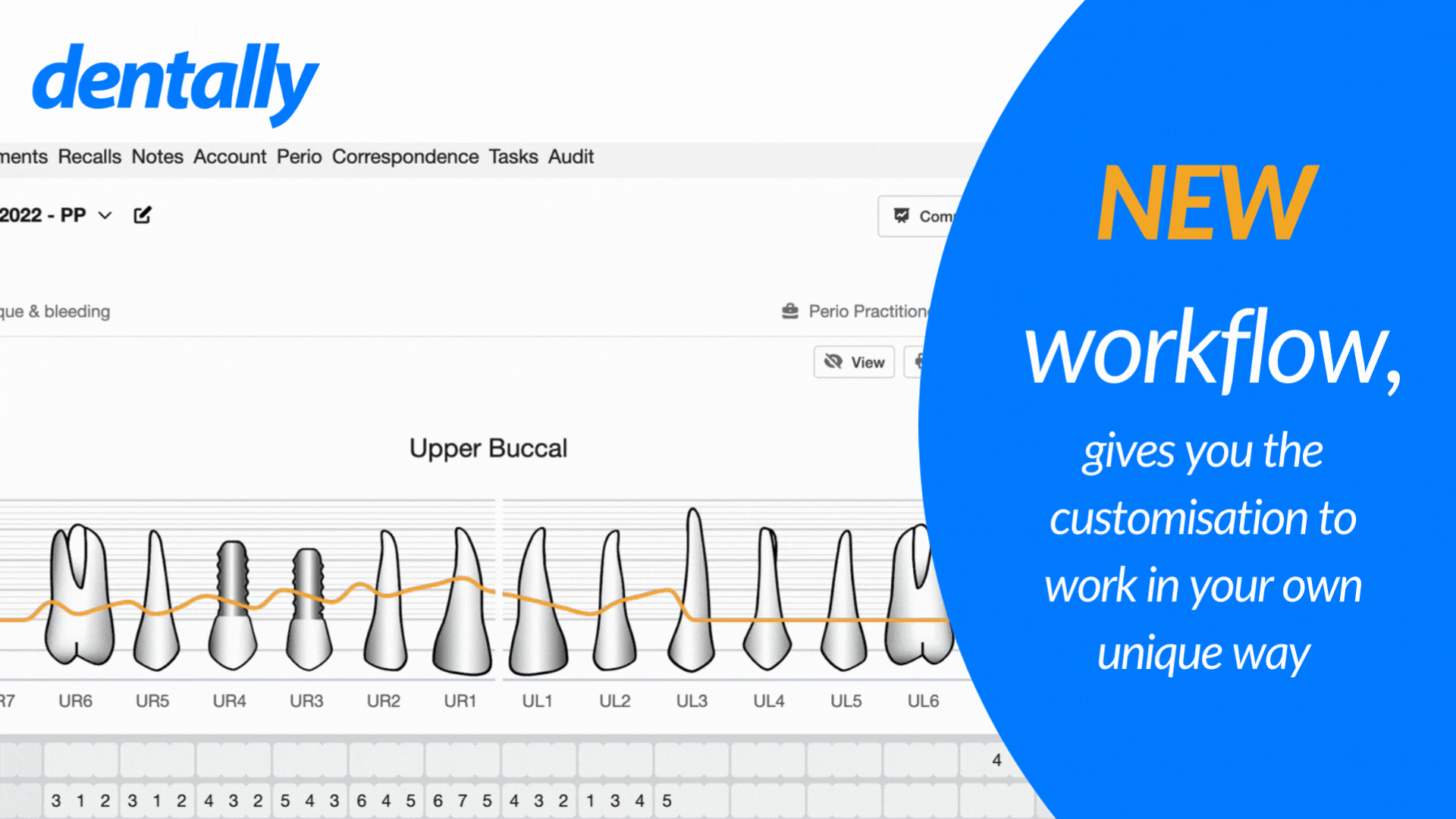 Intuitive view and workflow Perio Gif