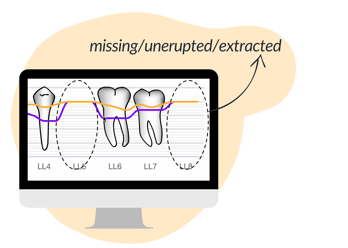 missing unerupted perio blog image nov 2022