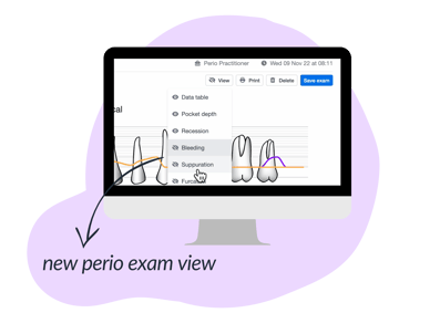 view perio exam settings blog nov 2022